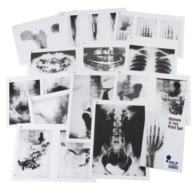 HUMAN X-RAY PRINT SET A4