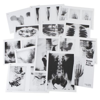 HUMAN X-RAY PRINT SET A3