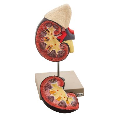 KIDNEY MODEL