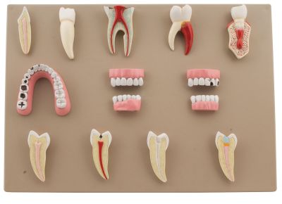 DENTAL DISEASE SET OF 14