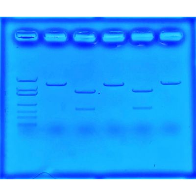 USING CRISPR TO TREAT CYSTIC FIBROSIS